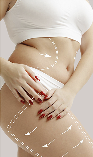 Cirugía plástica en Guadalajara: Servicio mommy makeover en Fernández cirugía plástica