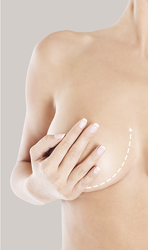 Cirugía plástica en Guadalajara: Servicio mamoplastia de aumento en Fernández cirugía plástica